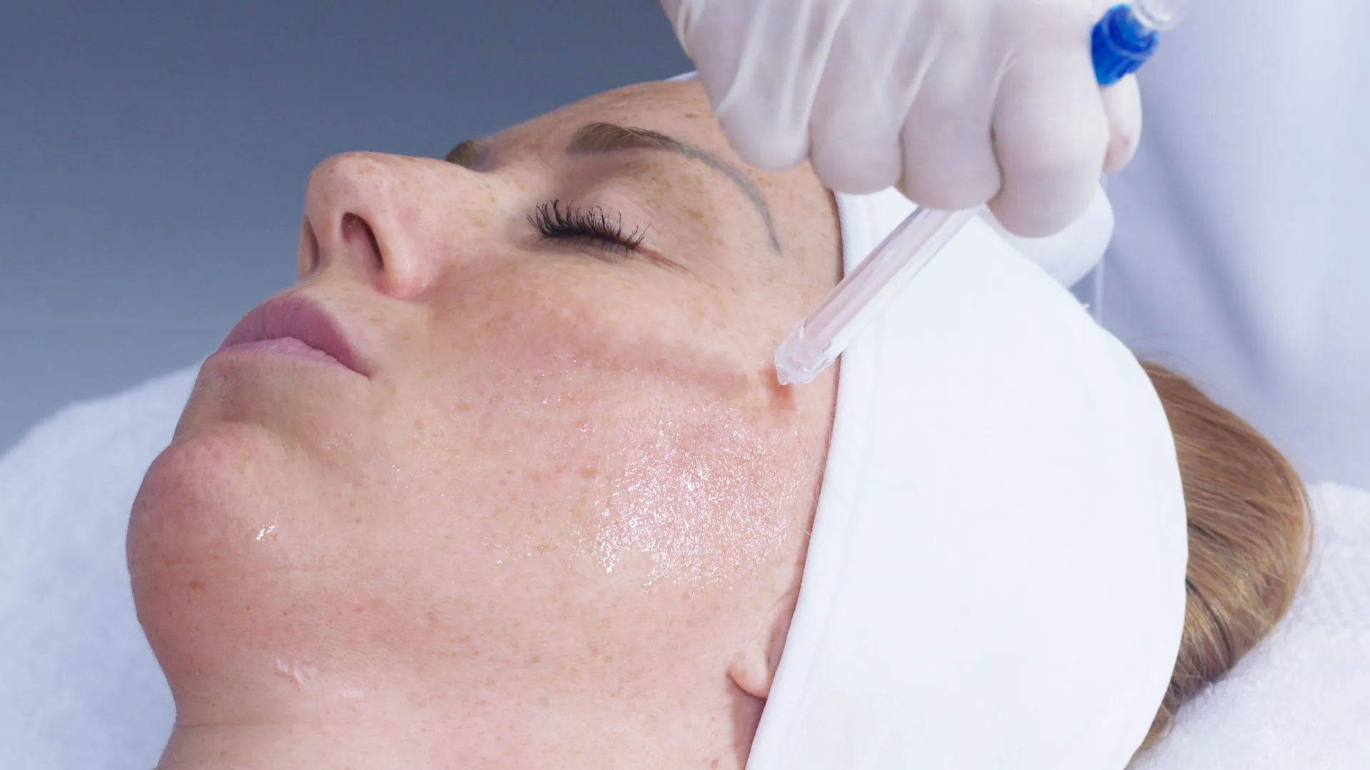 Traitement JetPeel professionnel en cabine - soin du visage personnalisé